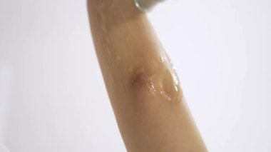 Vertical close up video of professional cosmetologist doing alexandrite laser hair removal of hand to young woman in modern beauty clinic