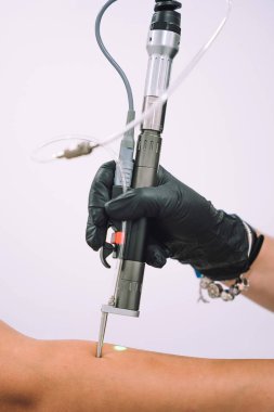 Close up shot of gloved hand with the laser hair removal machine's handpiece along woman hand. Alexandrite laser techhnology removing hair. Beauty procedureBeauty technology concept