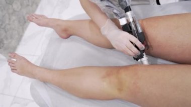 Close up video of professional cosmetologist doing alexandrite laser hair removal of legs to young woman in modern beauty clinic