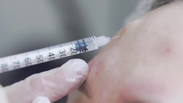 Beautician Läkare Gör Botox Injektion Pannan Unga Vackra Wpman Extremt — Stockvideo