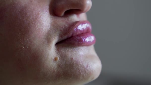 Närbild Skott Läppar Unga Vackra Wpman Efter Botox Injektion Extremt — Stockvideo