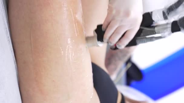 Verticale Close Video Van Professionele Cosmetoloog Doet Alexandriet Laser Ontharing — Stockvideo