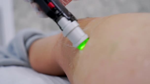 클리닉에 여성들에게 다리를 제거하는 알렉산더 레이저 수술을 전문적 학자의 모습을 — 비디오