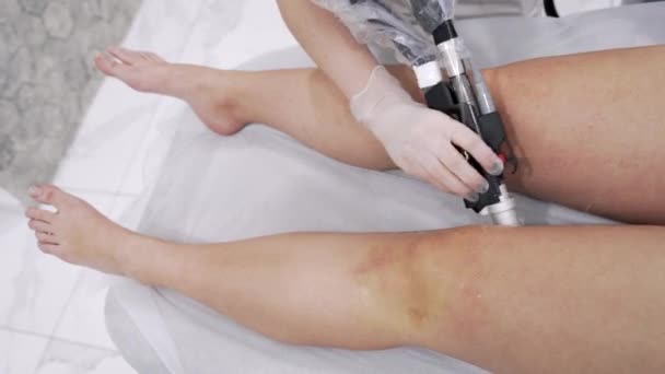 Close Video Professional Cosmetologist Doing Alexandrite Laser Hair Removal Legs — Vídeos de Stock