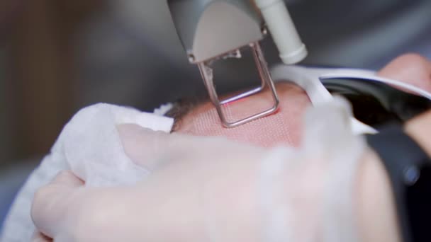 应用激光技术对美容师进行微囊微囊微囊微囊治疗年轻化手术的特写镜头 客户美容院五金美容术 — 图库视频影像