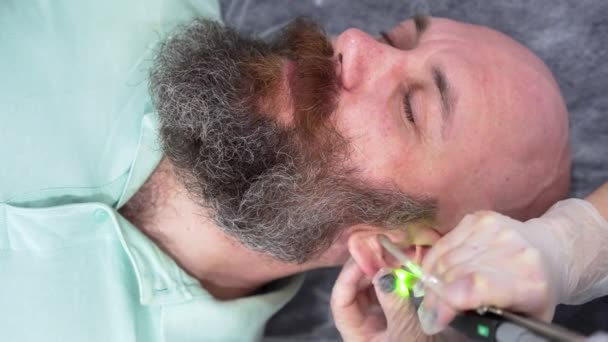Закройте Бородатый Дерзкий Человек Голову Депиляции Лазерные Волосы Процедуре Удаления — стоковое видео