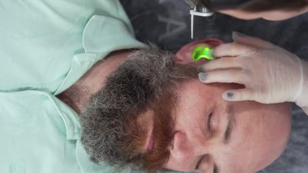 Close Bearded Bold Man Head Depilation Laser Hair Ears Removal — Stockvideo