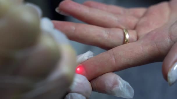 장갑을 외과의사는 현대식 클리닉의 손가락에서 레이저 기술을 사용하여 선풍기를 과아름다움의 — 비디오