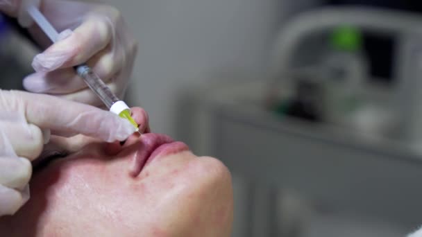 美容师医生把肉毒杆菌注射在年轻貌美的男巫的唇上 非常接近4000发子弹 美感科技概念 — 图库视频影像