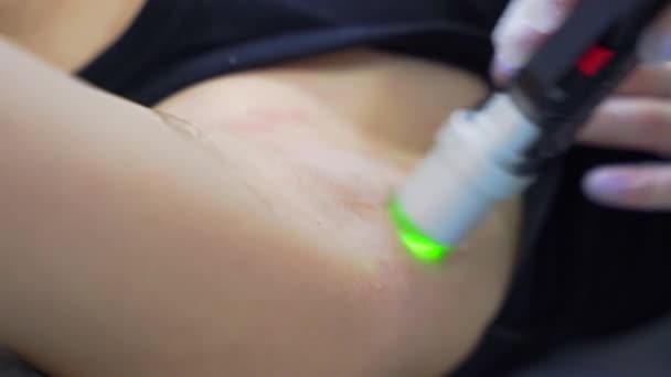 Профессиональный Косметолог Проводит Лазерную Эпиляцию Подмышки Молодой Женщине Салоне Красоты — стоковое видео