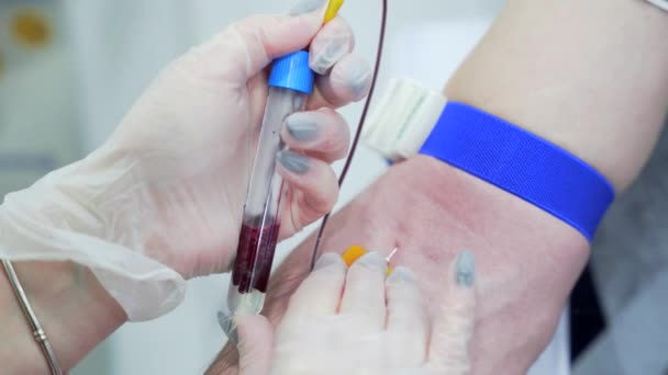 研究室の労働者の医者は分析のための血液サンプルを取ります 手を閉じて 実験室での採血 Prp治療手順の前に美容クリニックで血液を採取する ヘルスケアと美容 — ストック動画