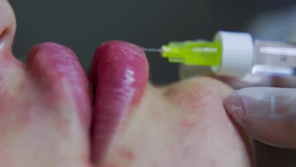 Beautician Läkare Gör Botox Injektion Läpparna Unga Vackra Wpman Extremt — Stockvideo