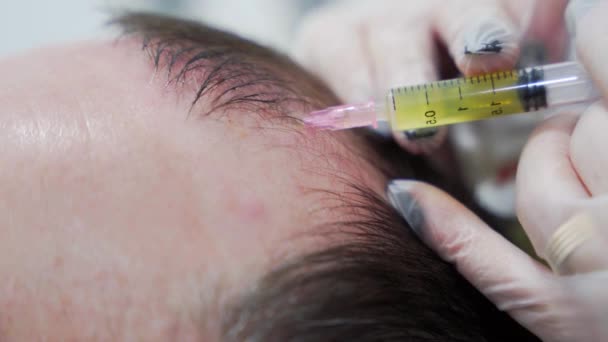 Макрознімок Процедури Мезотерапії Волосся Сучасній Косметологічній Клініці Єкції Плазми Чоловічий — стокове відео