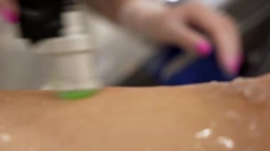 Profesyonel kozmetolojistin, güzellik salonundaki genç bayana, vücut bakımı epilasyonu tedavisinde lazer kılı kesme videosunu kapatın. Güzellik konsepti.