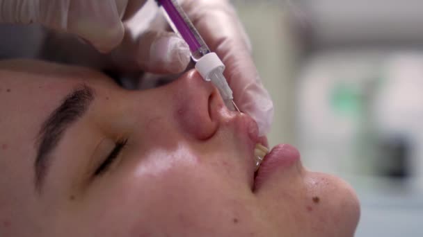 ビーガン医師は 若い美しい女性の唇にボトックス注射をする エクストリームクローズ 4Kショット 美容技術コンセプト — ストック動画