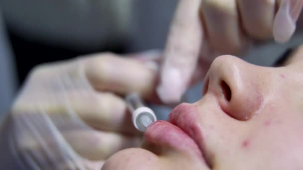 ビーガン医師は 若い美しい女性の唇にボトックス注射をする エクストリームクローズ 4Kショット 美容技術コンセプト — ストック動画