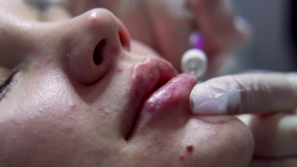 Kosmetikerin Arzt Macht Botox Injektion Die Lippen Der Jungen Schönen — Stockvideo