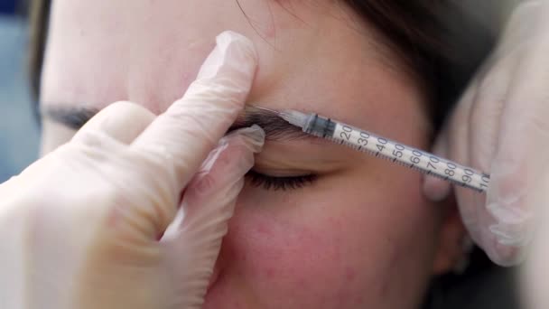 Vackra Läkare Gör Botox Injektion Pannan Ung Vacker Kvinna Extremt — Stockvideo
