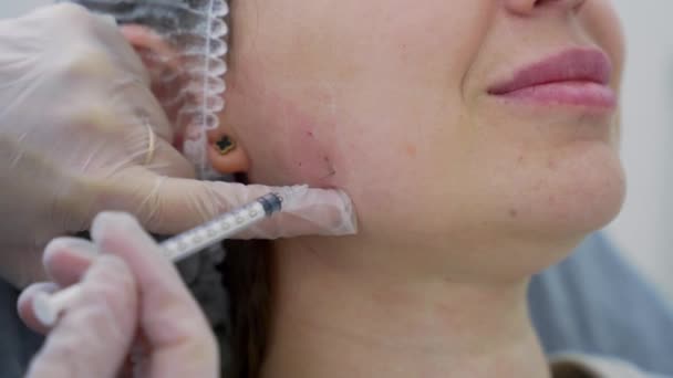 美容师医生在年轻漂亮女人的颧骨上注射肉毒杆菌素 非常接近4000发子弹 美感科技概念 — 图库视频影像
