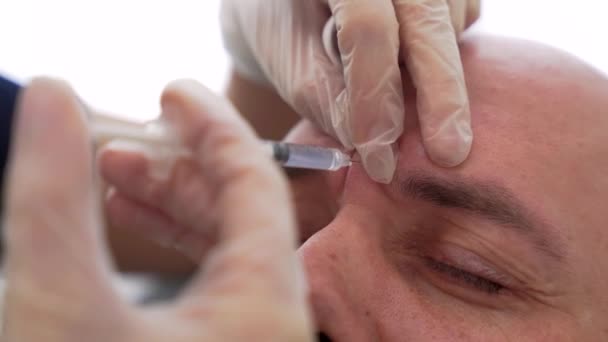 아름다운 의사의 클로즈업 용감한 남자의 부분에 Botox 주사를 만든다 피부를 — 비디오