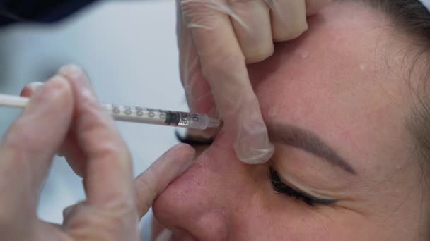 Kozmetikus Orvos Botox Injekciót Fiatal Gyönyörű Homlokába Szélsőséges Közel Lövés — Stock videók