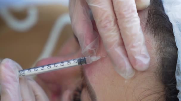 Médico Esteticista Faz Injeção Botox Testa Jovem Mulher Bonita Extremo — Vídeo de Stock