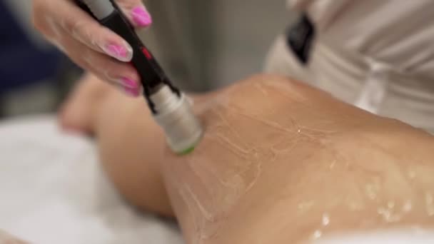 Närbild Video Professionell Kosmetolog Gör Laser Hårborttagning Ben Till Ung — Stockvideo