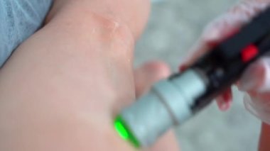 Profesyonel kozmetolojistin, güzellik salonundaki genç bayana, vücut bakımı epilasyonu tedavisinde lazer kılı kestiği dikey çekim videosu. Güzellik konsepti.