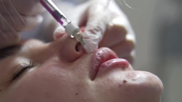 Beautician Arts Maakt Botox Injectie Lippen Van Jonge Mooie Vrouw — Stockvideo
