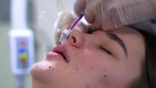 Beautician Arts Maakt Botox Injectie Lippen Van Jonge Mooie Vrouw — Stockvideo