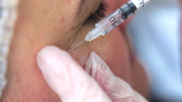 Kozmetikus Orvos Botox Injekciót Fiatal Gyönyörű Arccsontjába Szélsőséges Közel Lövés — Stock videók
