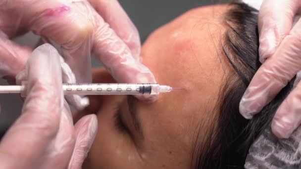 아름다운 의사는 아름다운 여자의 이마에 Botox 주사를합니다 익스트림 클로즈업 아름다움 — 비디오
