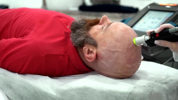 Close Baardvet Man Hoofd Ontharing Laser Ontharing Procedure Behandeling Onpijnlijke — Stockvideo
