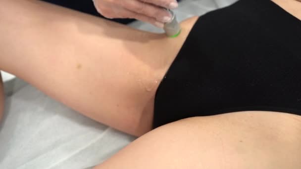 亚力山大激光在美学医学中的近照 流口水 女性在激光脱毛治疗大腿和比基尼地区 美容师用激光去除比基尼区的头发 — 图库视频影像