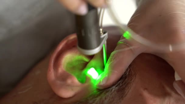 Odważna Depilacja Głowy Człowieka Laserowa Depilacja Usuwaniu Uszu Zabieg Laserowy — Wideo stockowe