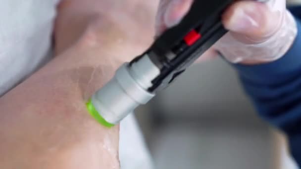 Vertikales Nahaufnahme Video Eines Professionellen Kosmetikers Bei Der Alexandrit Laser — Stockvideo