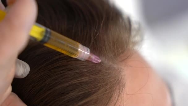 Γιατρός Κάνει Ενέσεις Πλάσματος Στο Κεφάλι Για Υγιή Ανάπτυξη Μαλλιών — Αρχείο Βίντεο