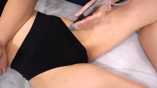 Zamknij Ujęcie Alexandrite Laser Medycynie Estetycznej Depilacja Kobieta Zabiegi Depilacji — Wideo stockowe