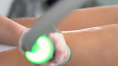 Modern kozmetoloji kliniğinde kriyolipolisis yağ tedavisi prosedürü. Genç bayanın bacağına cerrahi liposakşın yapılmamış. Güzellik konsepti. 4K görüntüsünü kapat.