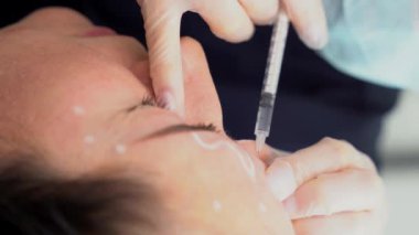 Güzellik doktoru genç ve güzel bir kadının alnına botoks yapar. 4K dikey çekim için aşırı yakın çekim. Güzellik teknolojisi kavramı