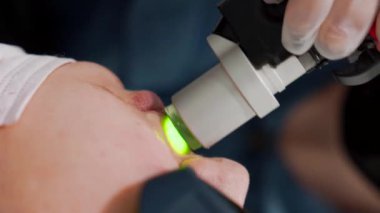 Kadın, güzellik salonunda modern İskenderiye lazer lazer temizleme prosedürüyle karşı karşıya. Kadın güzelliği, kozmetik bilimi, epilasyon kavramı. Dikey çekim.