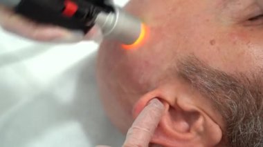 Sakallı cesur adam kafa tüy dökücü lazer temizleme işlemi, acısız prosedür, güzellik konsepti, Alexandrite lazer.