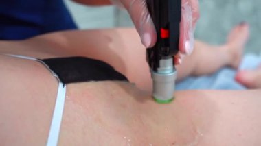 Estetik tıp alanında İskenderiye Lazeri 'ni yakından çek. Epilasyon. Lazer tüy temizleme tedavisi gören bir kadın. Baldırları ve bikini bölgesi. Güzellik uzmanı lazer kullanarak bikini bölgesindeki kılları alıyor. Alınıyor