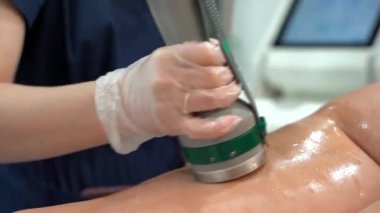 Modern kozmetoloji kliniğinde kriyolipolisis yağ tedavisi prosedürü. Genç bayanın bacağına cerrahi liposakşın yapılmamış. Güzellik konsepti. 4K görüntüsünü kapat.