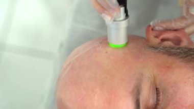 Sakallı cesur adam kafa tüy dökücü lazer temizleme işlemi, acısız prosedür, güzellik konsepti, Alexandrite lazer.