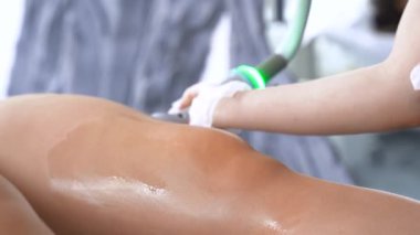 Modern kozmetoloji kliniğinde kriyolipolisis yağ tedavisi prosedürü. Genç bayanın bacağına cerrahi liposakşın yapılmamış. Güzellik konsepti. 4K görüntüsünü kapat.