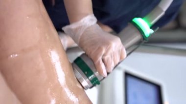 Modern kozmetoloji kliniğinde kriyolipolisis yağ tedavisi prosedürünün dikey aşısı. Genç bayanın bacağına cerrahi liposakşın yapılmamış. Güzellik konsepti. 4K görüntüsünü kapat.