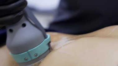Modern kozmetoloji kliniğinde kriyolipolisis yağ tedavisi prosedürü. Genç bir kadının midesinde cerrahi olmayan yağ aldırma. Güzellik konsepti. 4K görüntüsünü kapat.