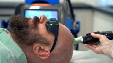 Sakallı cesur adam kafa tüy dökücü lazer temizleme işlemi, acısız prosedür, güzellik konsepti, Alexandrite lazer.