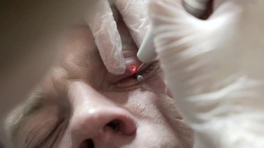 Bir dermatolog, modern bir lazer teknolojisi kliniğinde lazerle göz kapağındaki neoplazmayı, sağlık, güzellik ve bakım kavramını söker. 4k renk düzeltmeli çekimi kapat